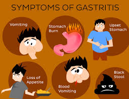 Obat Tradisional Gastritis